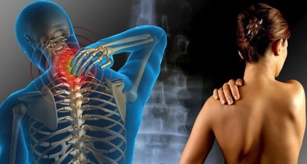Smärta från fibromyalgi