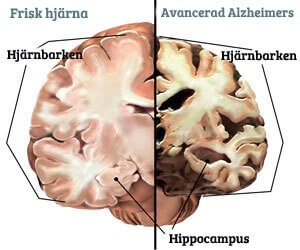 Hippocampus