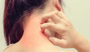stress utslag i ansiktet stress utslag i ansiktet