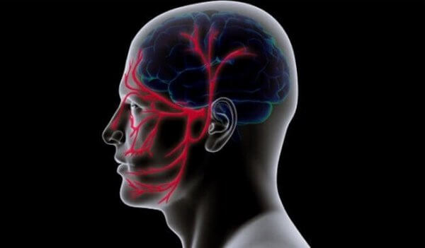 Huvud med illustrerad trigeminusneuralgi