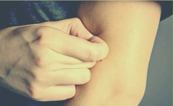 Person med dermatillomani som nyper sig i huden.