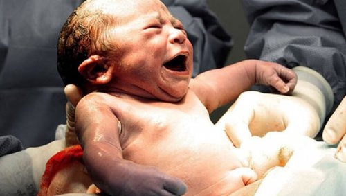 Födelsetraumat påverkar den mänskliga erfarenheten