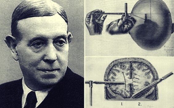 Egas Moniz och lobotomins fantastiska historia