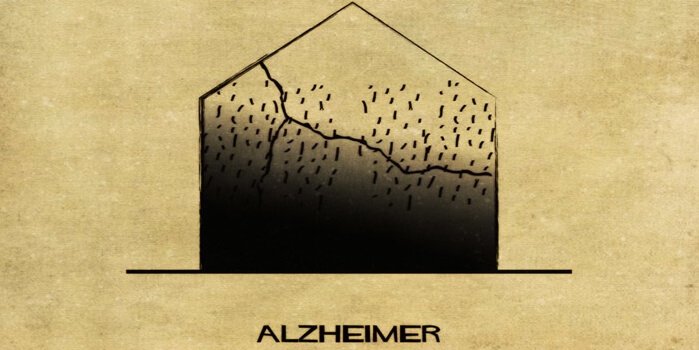 Representation av Alzheimers.