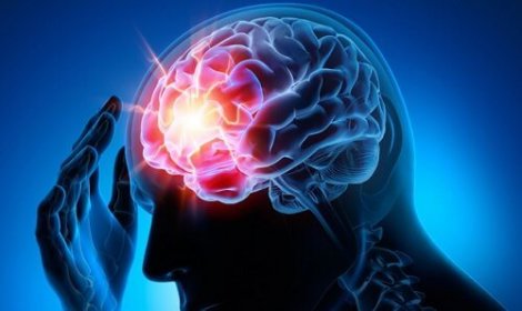 aneurysm i hjärnan aneurysm i hjärnan