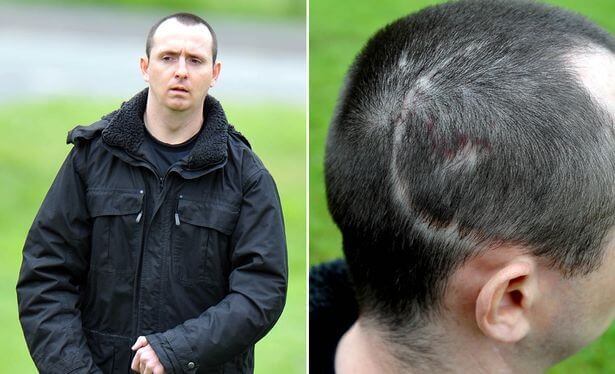 Paul Pugh misshandlades svårt