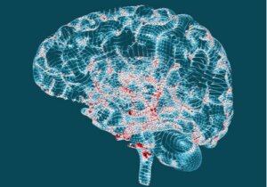 Tecken på Huntingtons sjukdom du bör känna till
