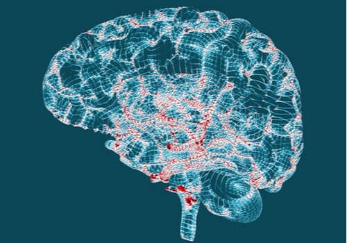 Tecken på Huntingtons sjukdom du bör känna till