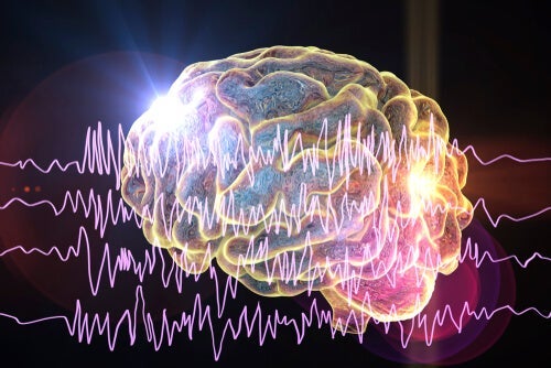 Vid epilepsi registrerar man onormal hjärnaktivitet