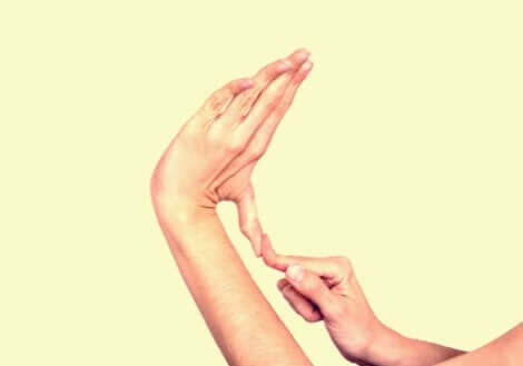 En kvinna med Ehlers-Danlos syndrom