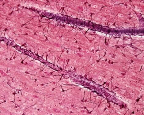 Ett foto av hjärnvävnad