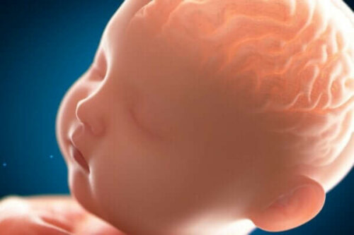 Tillståndet pakygyri: en ”slät” hjärna