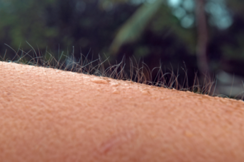 Hudorgasmer, när musik ger dig gåshud